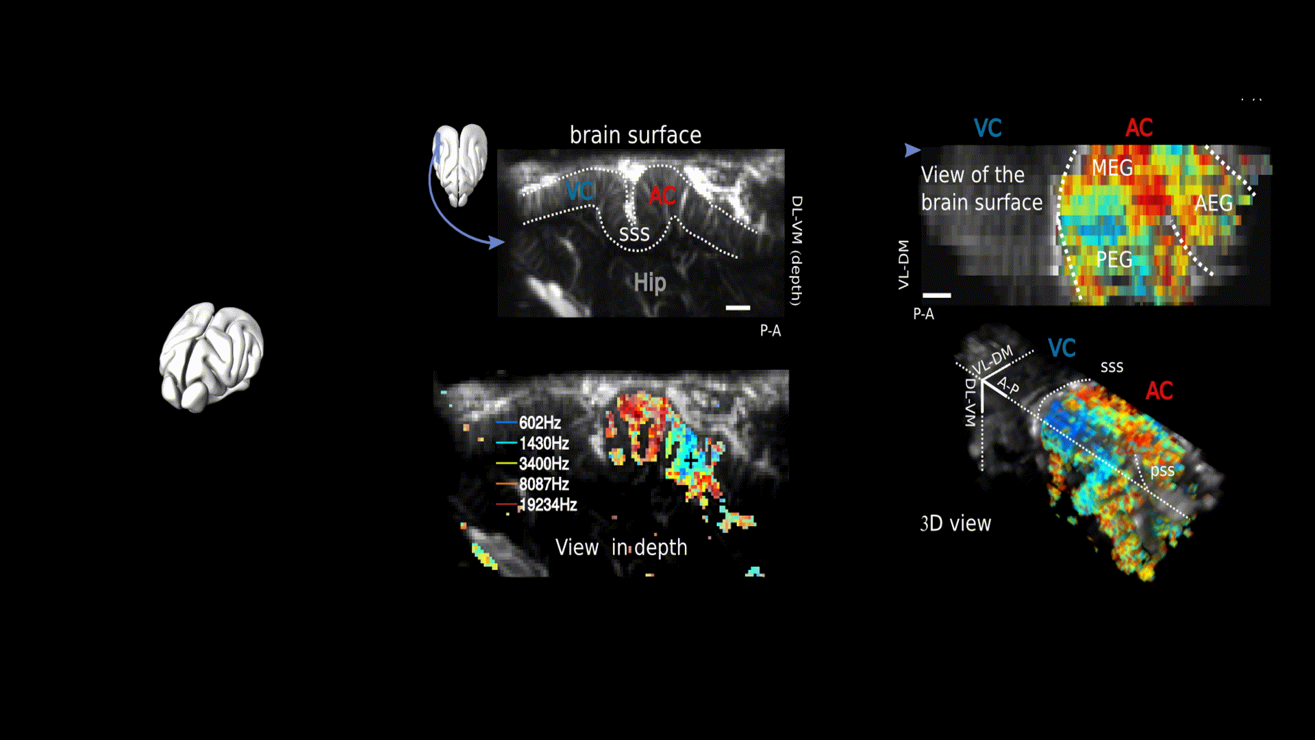 Exposure to pure tones of five frequencies resulted in areas of heightened activity, as shown in this view of a tilted parasagittal slice of the visual cortex (VC) and auditory cortex (AC) in the ferret